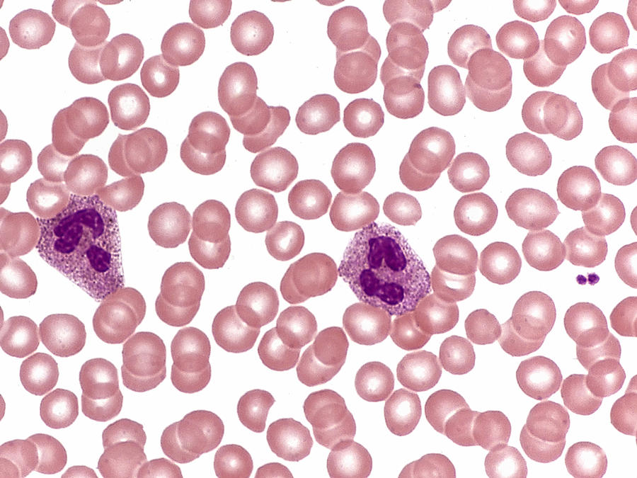 Red And White Blood Cells, Lm #6 Photograph by Alvin Telser