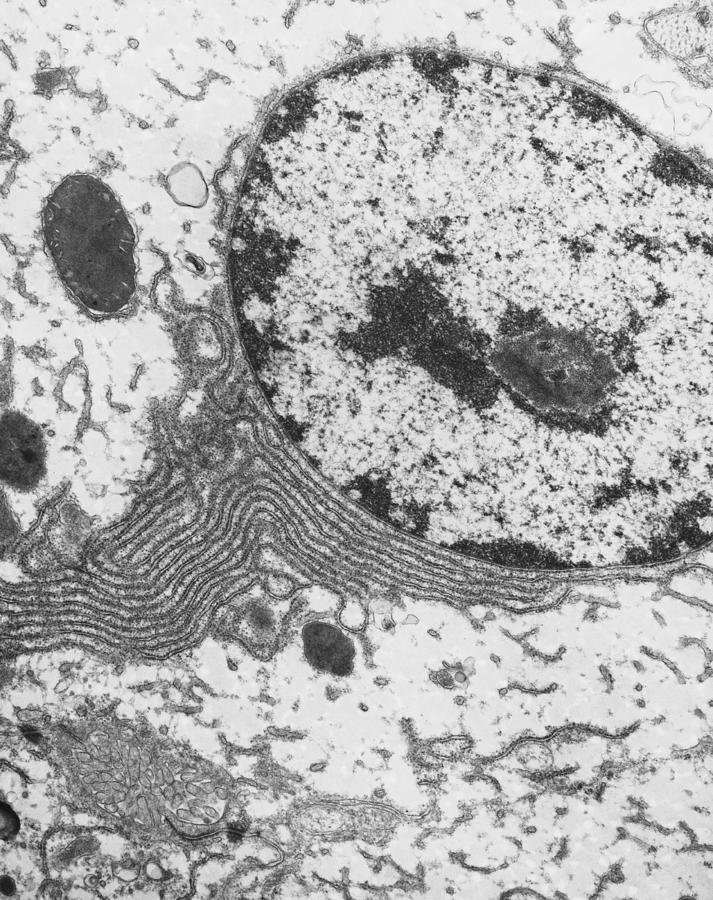 Rough Endoplasmic Reticulum, Tem Photograph By Joseph F. Gennaro Jr 