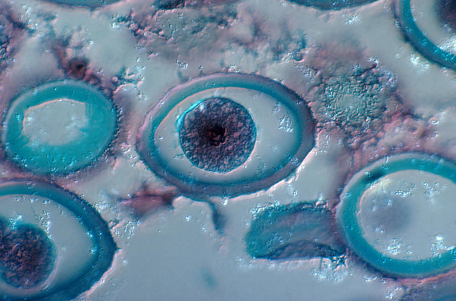Roundworm Cells In Metaphase, Lm #7 Photograph by Joseph F. Gennaro Jr.