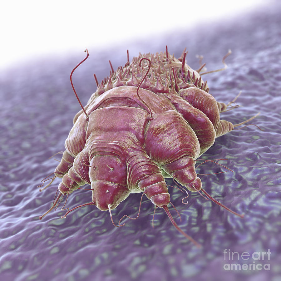 Scabies Mite Photograph By Science Picture Co Fine Art America