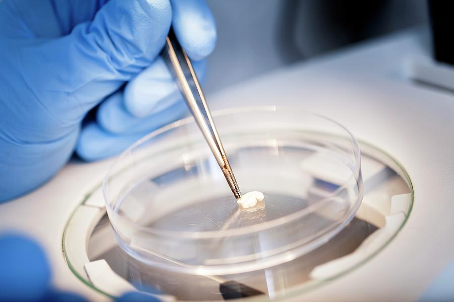 Sperm Whale Tissue Analysis Photograph by Thomas Fredberg | Fine Art ...