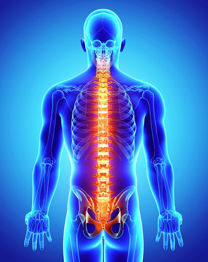 Spine Pain Photograph by Pixologicstudio/science Photo Library - Fine ...