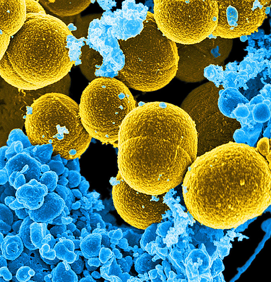 Staphylococcus Aureus Bacteria, Sem #7 Photograph by Science Source