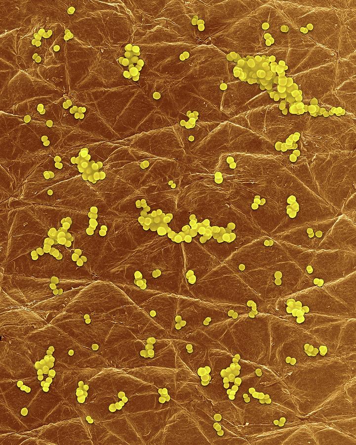 Staphylococcus Aureus On Human Skin Photograph By Dennis Kunkel