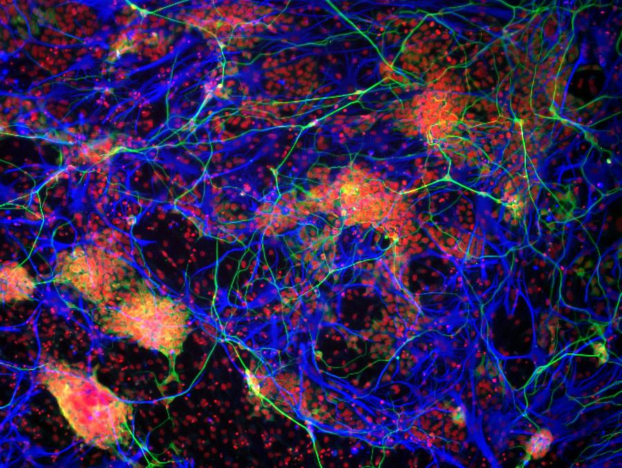 Stem cell-derived nerve cells #7 Photograph by Science Photo Library