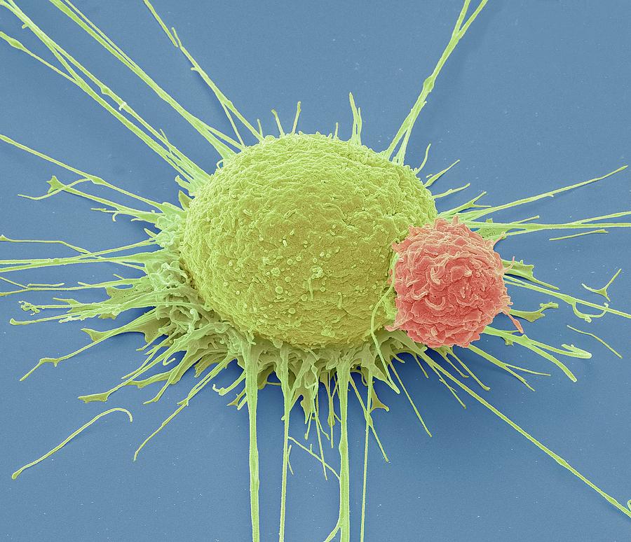 T Lymphocyte And Cancer Cell #7 Photograph by Steve Gschmeissner