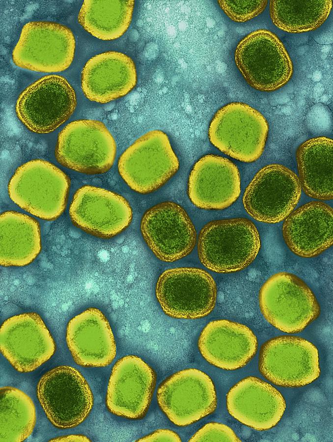 Biological Photograph - Variola Virus #7 by Dennis Kunkel Microscopy/science Photo Library