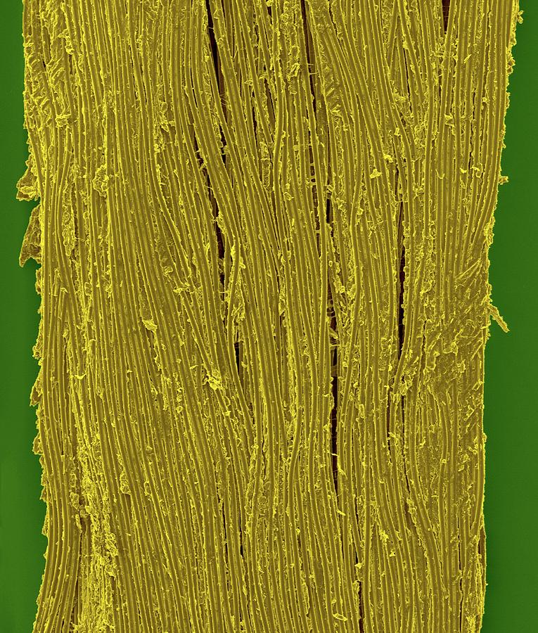 Dental Floss Photograph - Waxed Dental Floss by Dennis Kunkel Microscopy/science Photo Library Dental Floss Photograph - Waxed Dental Floss by Dennis Kunkel Microscopy/science Photo Library