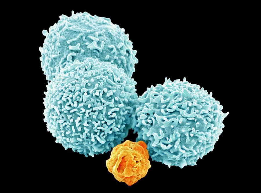 White blood cells, SEM #7 Photograph by Steve Gschmeissner