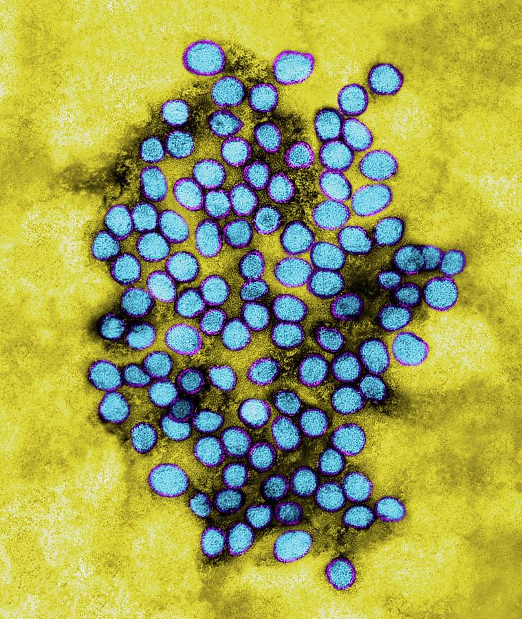 Yellow Fever Virus #7 Photograph by Science Photo Library - Pixels