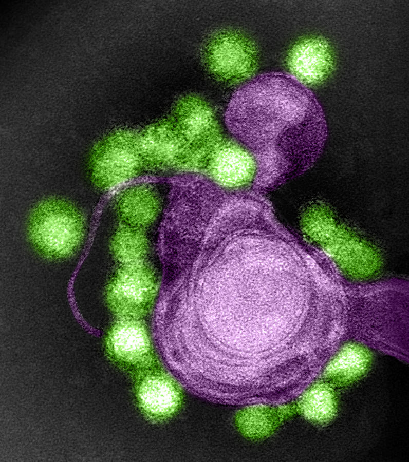 Zika Virus, Tem #7 Photograph by Science Source