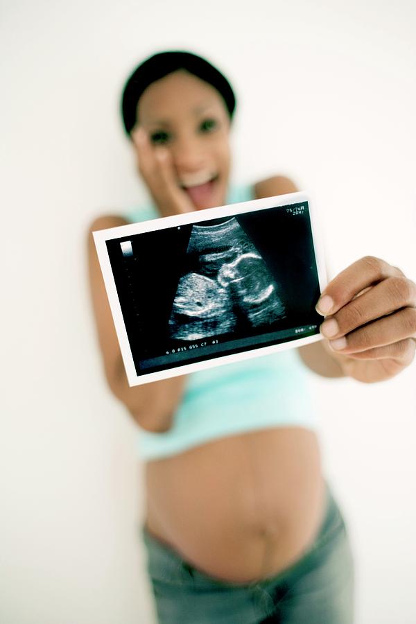 Pregnant Woman #78 Photograph by Ian Hooton/science Photo Library