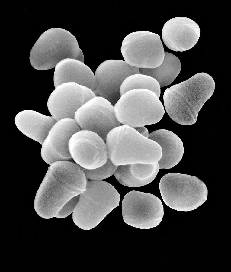 Black And White Photograph - Arthrobacter Sp. #8 by Dennis Kunkel Microscopy/science Photo Library