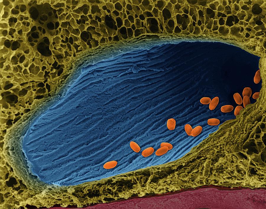 Bacillus Anthracis Spores In Lung Photograph by Dennis Kunkel ...