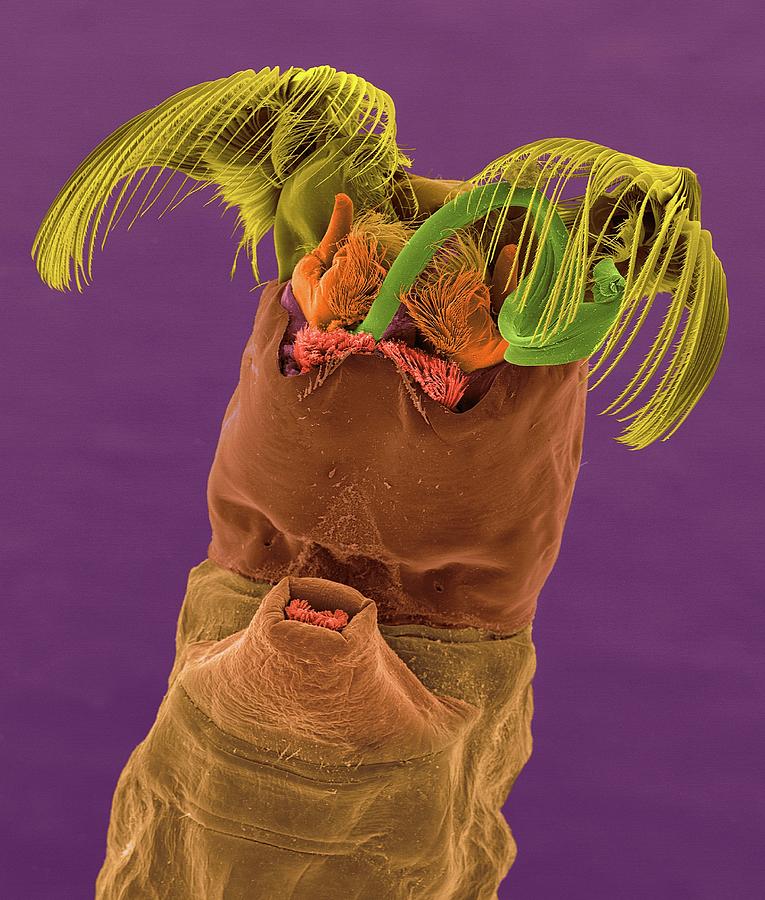 Black Photograph - Black Fly Larva by Dennis Kunkel Microscopy/science Photo Library Black Photograph - Black Fly Larva by Dennis Kunkel Microscopy/science Photo Library