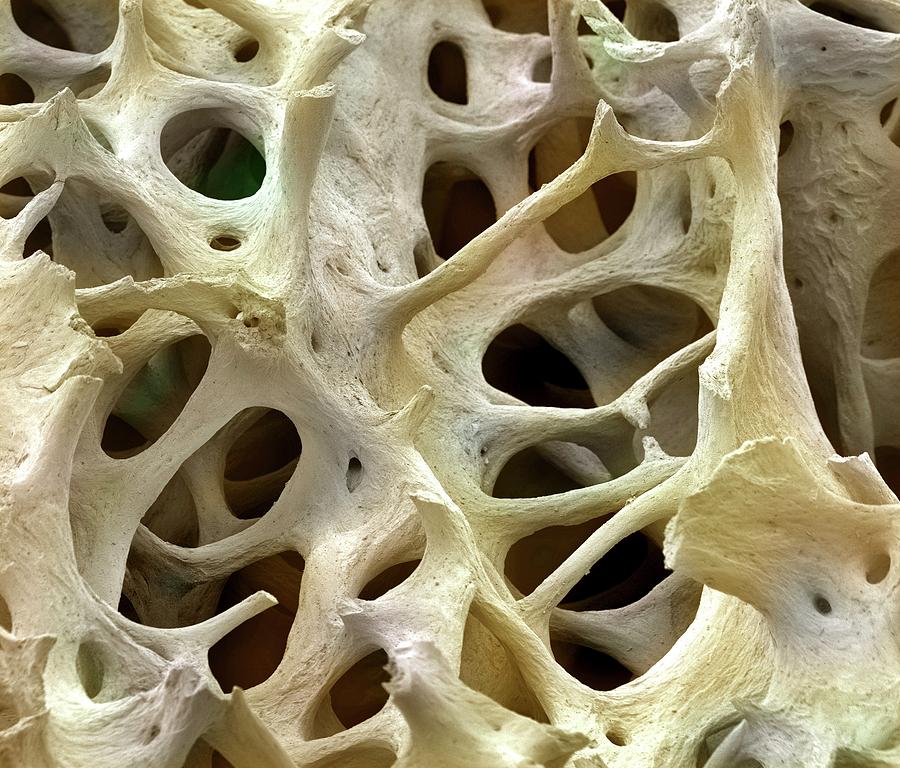 Bone Tissue #8 Photograph by Steve Gschmeissner - Pixels