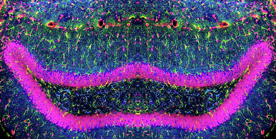 Brain Cells #8 Photograph by Dr. Chris Henstridge