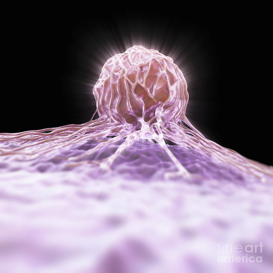Breast Cancer Cell #12 Photograph by Science Picture Co