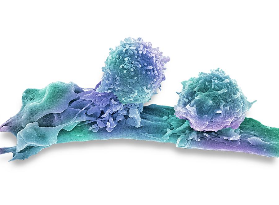 Cancer Cell And T Lymphocytes #8 Photograph by Steve Gschmeissner