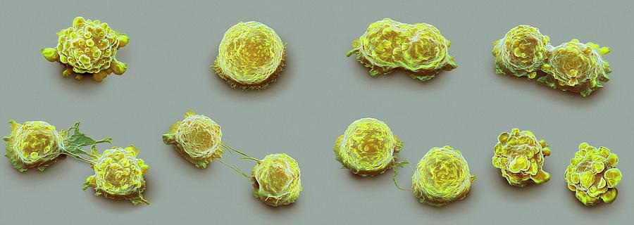 Cancer Cell Division Photograph By Steve Gschmeissner 9432