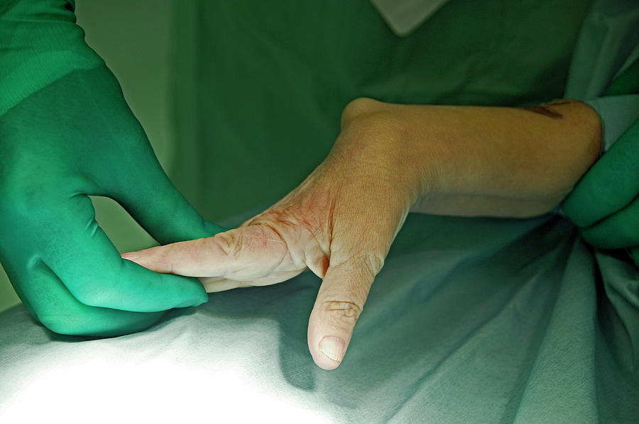 carpel tunnel surgery carpel tunnel surgery