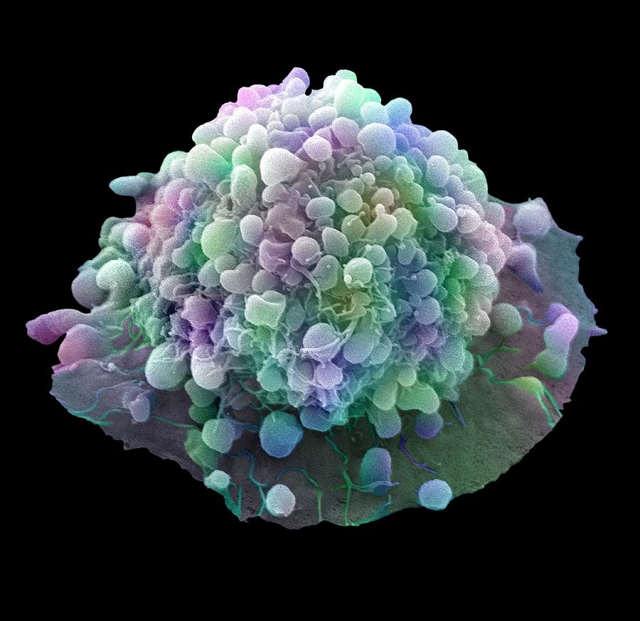 Cervical Cancer Cell Photograph By Steve Gschmeissner Pixels