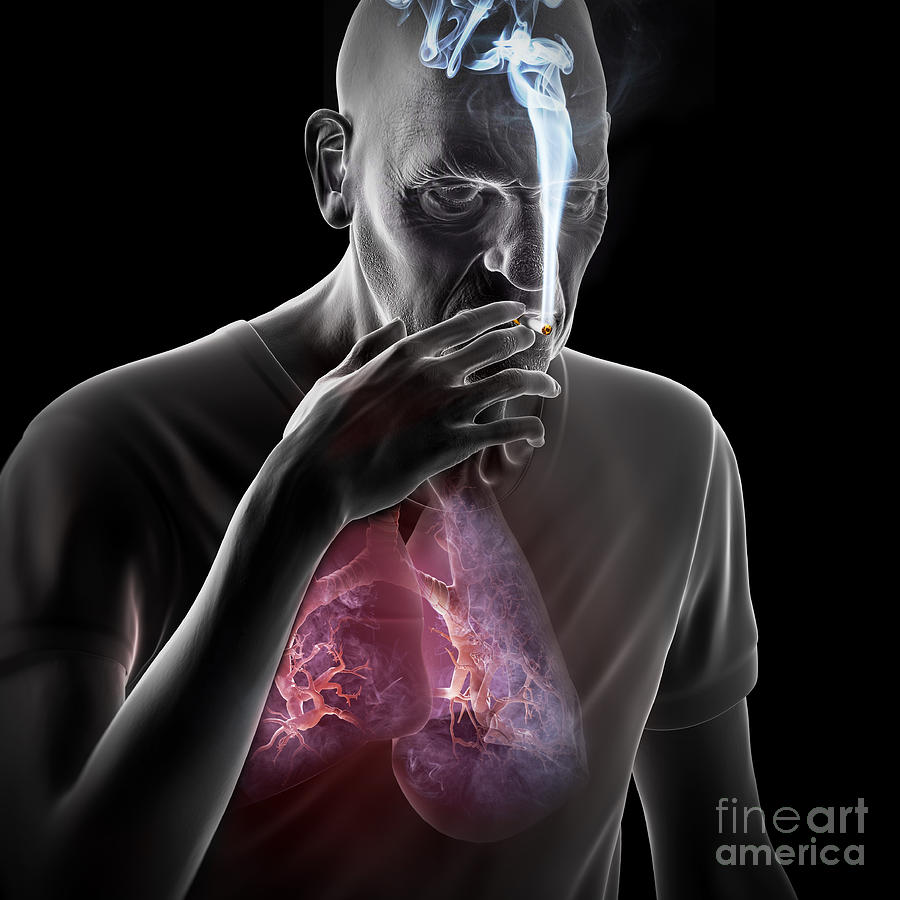 Dangers Of Smoking #8 Photograph by Science Picture Co