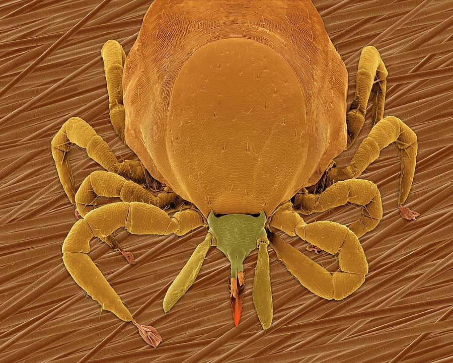 Deer Tick (ixodes Scapularis) #8 Photograph by Dennis Kunkel Microscopy/science Photo Library