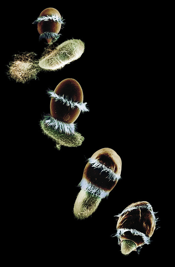 Didinium Ingesting Paramecium #8 Photograph by Greg Antipa