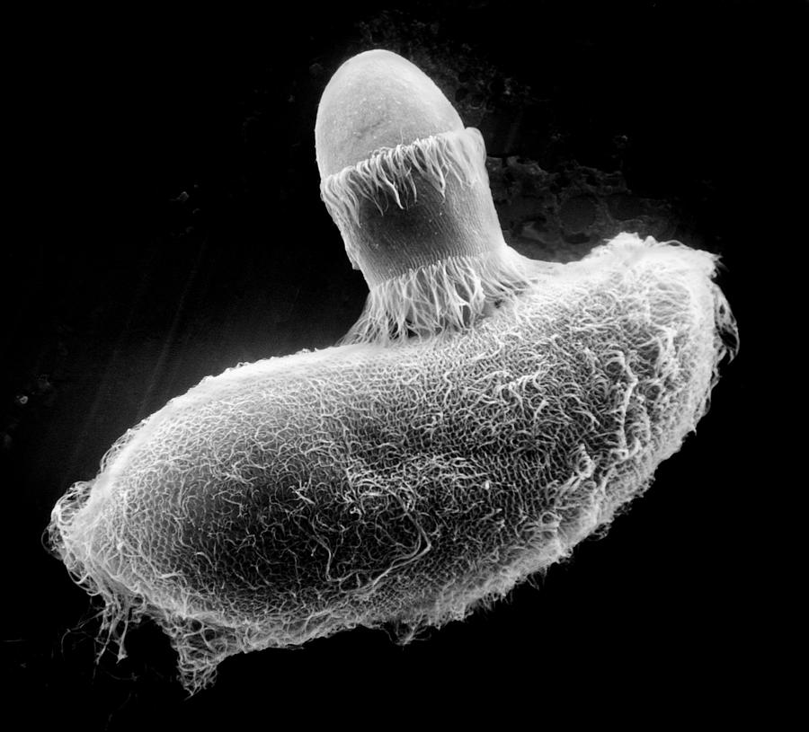Didinium Ingesting Paramecium, Sem #8 Photograph by Greg Antipa