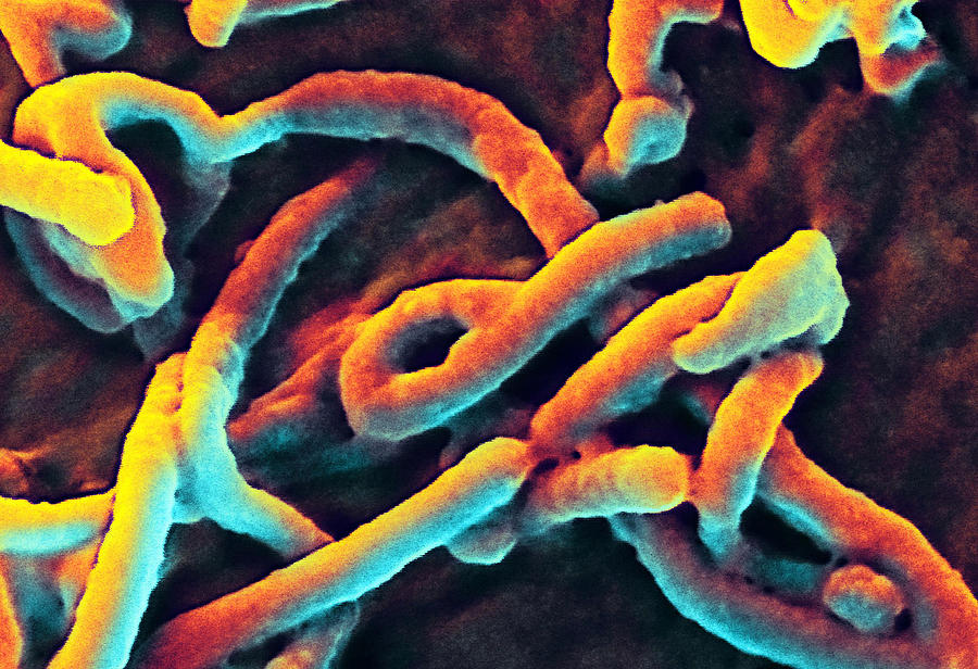 Ebola Virus, Sem #11 Photograph by Science Source