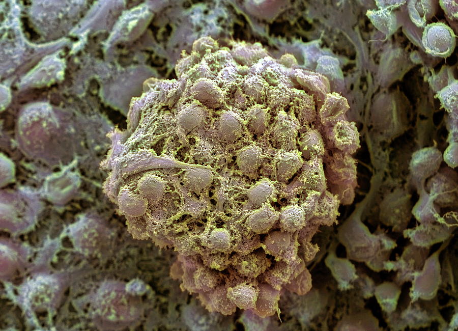 Embryonic Stem Cells #8 Photograph by Professor Miodrag Stojkovic/science Photo Library