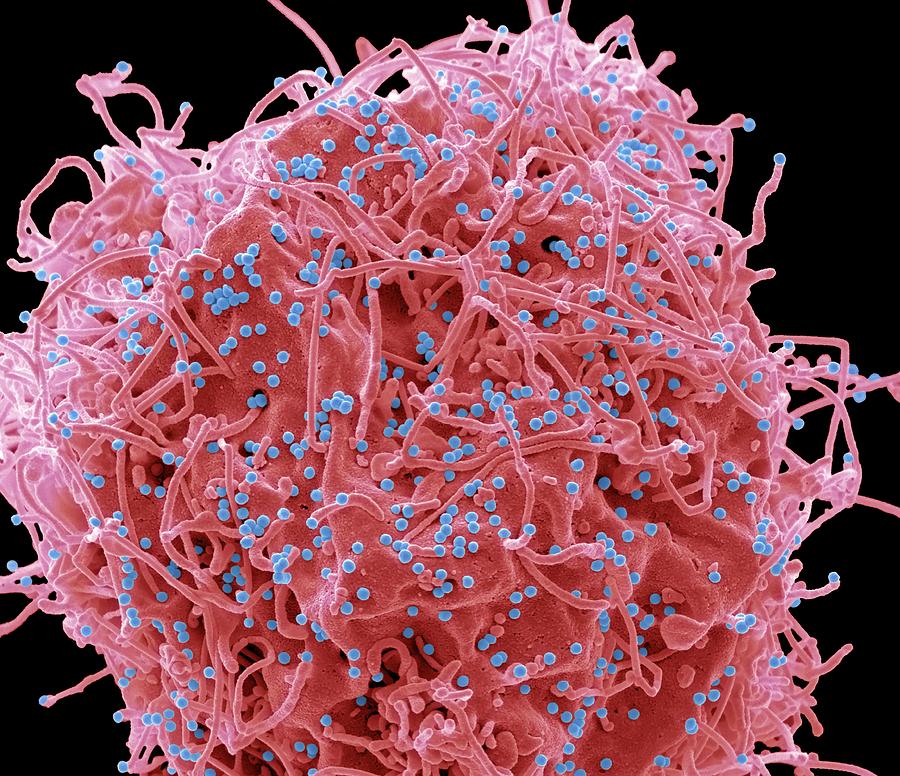 Hiv Infected Cell Photograph By Steve Gschmeissner Science Photo 