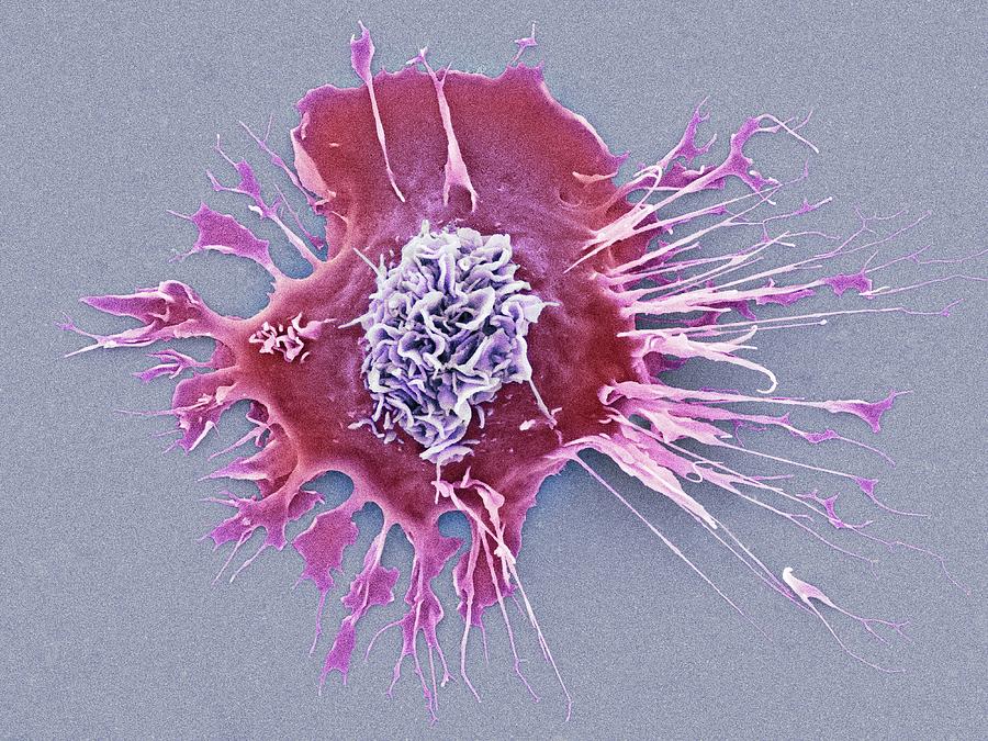 Human Dendritic Cell Photograph By Dennis Kunkel Microscopyscience Photo Library Pixels 