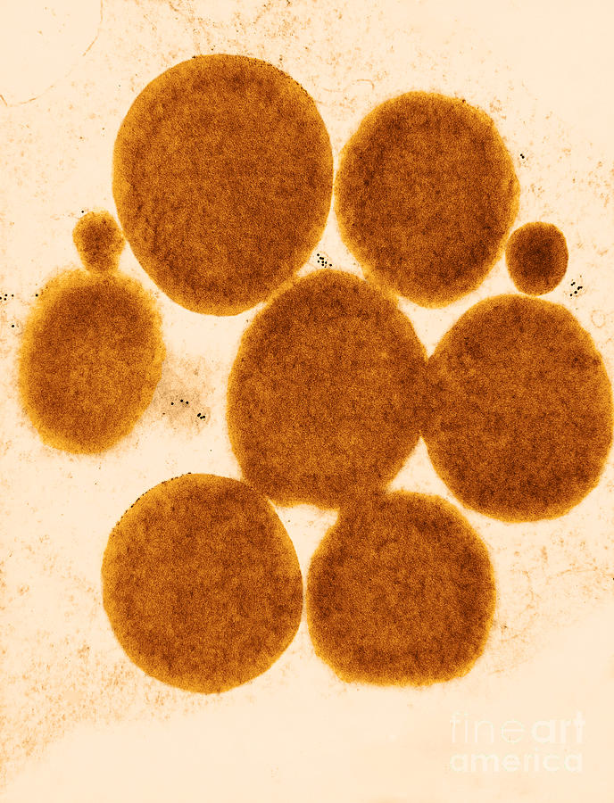 Lipid Droplets Tem #8 Photograph by David M. Phillips