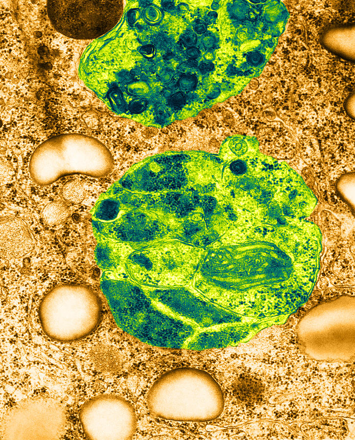 Lysosomes, Tem #8 Photograph by Science Source