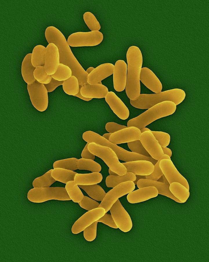 Mycobacterium Tuberculosis #8 Photograph by Dennis Kunkel Microscopy ...