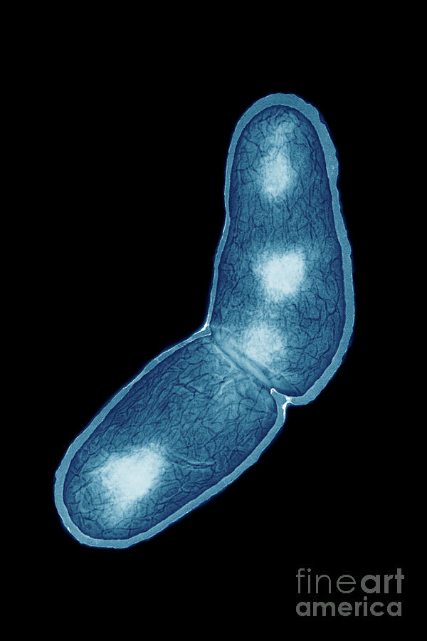 Transmission Electron Microscope Photograph - Mycobacterium Tuberculosis #8 by Kwangshin Kim