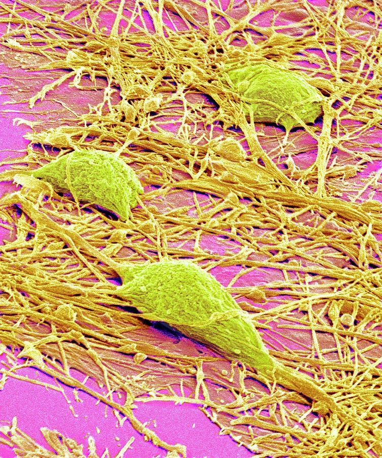 Nervous System Cells #8 Photograph by Susumu Nishinaga