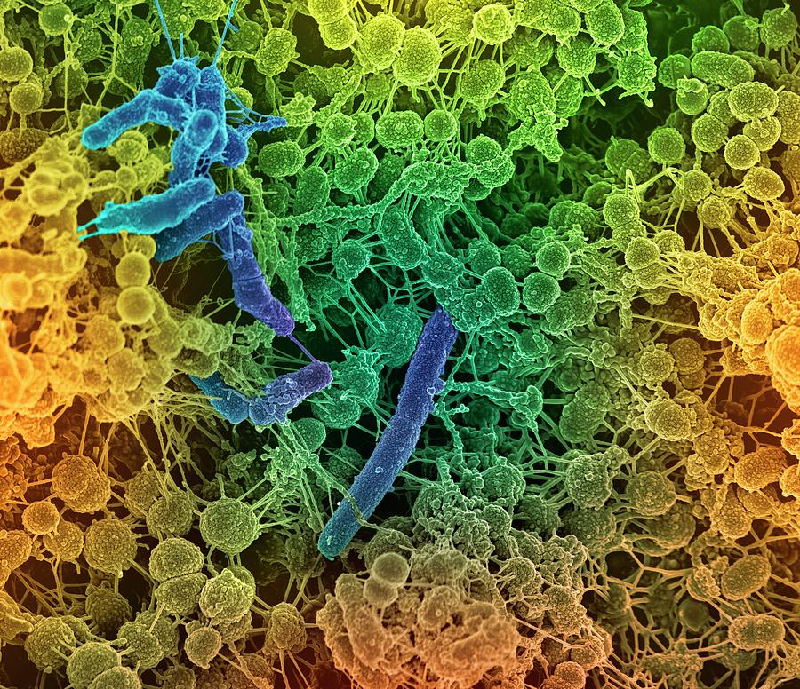 oral-bacteria-photograph-by-science-photo-library-pixels