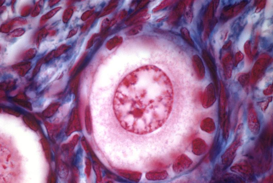 Folliculogenesis Photograph - Ovarian follicle, light micrograph #8 by Science Photo Library