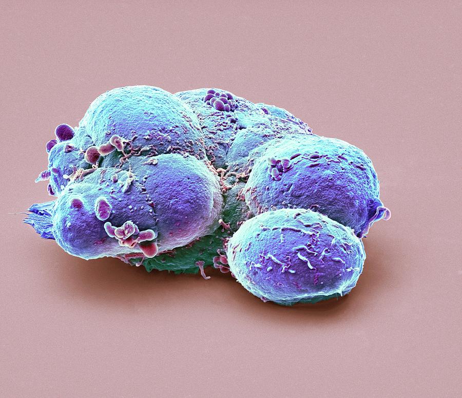 Pluripotent Stem Cells #8 Photograph by Steve Gschmeissner