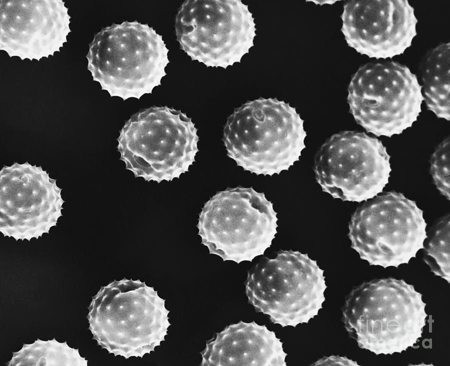 Ragweed Pollen Sem Photograph by David M. Phillips / The Population Council