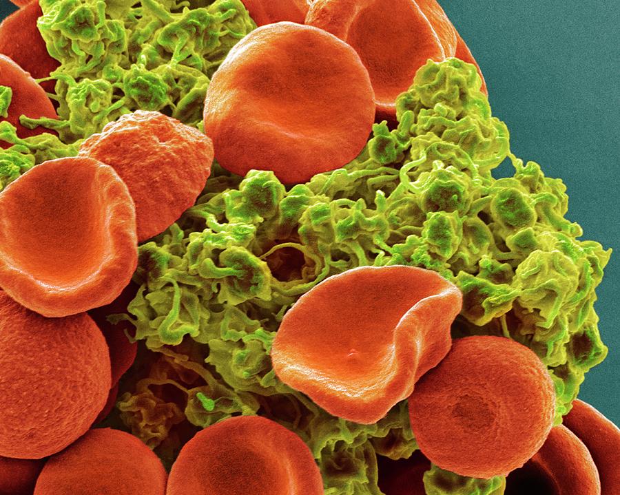Activated Photograph - Red Blood Cells And Platelets #8 by Steve Gschmeissner