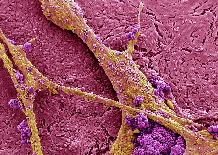 Stem Cells #8 Photograph by Professor Miodrag Stojkovic/science Photo Library