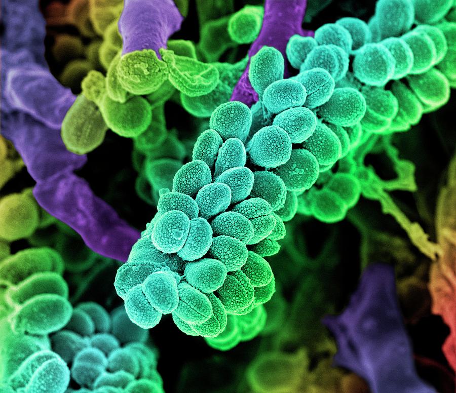 Streptococcus Bacteria #8 Photograph by Science Photo Library