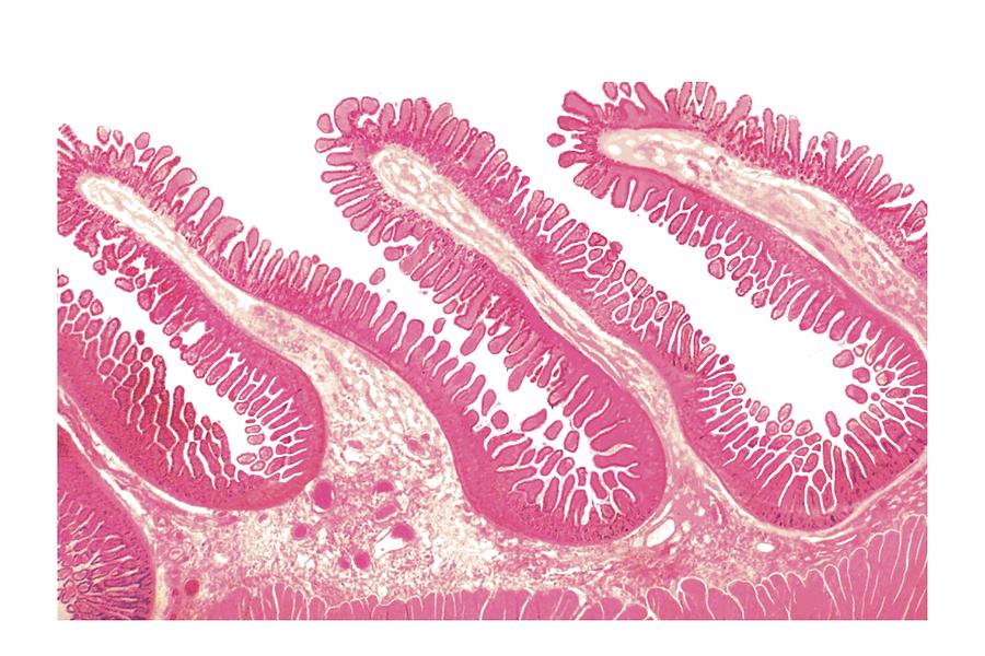 Structure Of Intestinal Tract #8 Photograph by Asklepios Medical Atlas