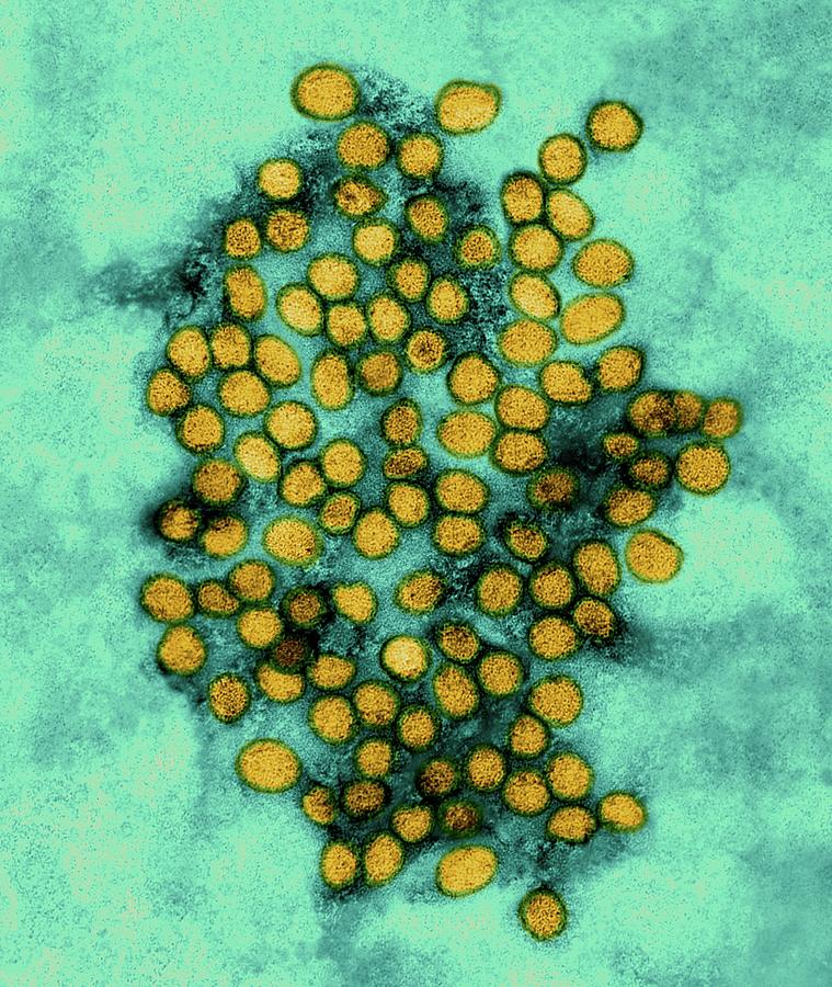 Yellow Fever Virus Photograph by Dennis Kunkel Microscopy/science Photo ...