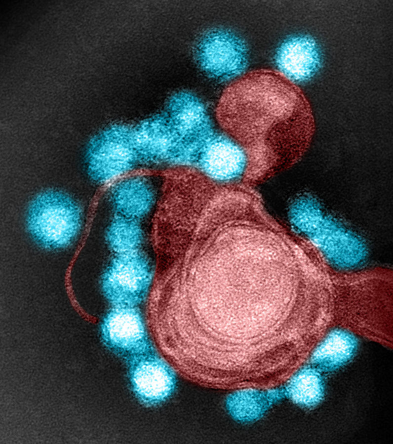 Zika Virus, Tem #8 Photograph by Science Source