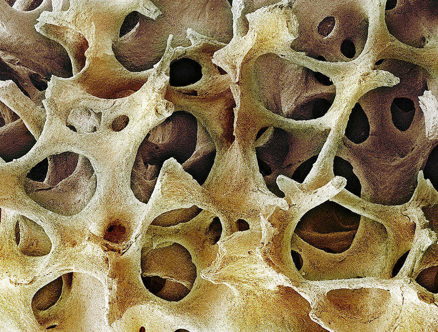 Bone Tissue #9 Photograph by Steve Gschmeissner
